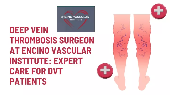 deep vein thrombosis surgeon at encino vascular