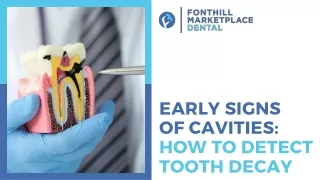 Early Signs of Cavities: How to Detect Tooth Decay