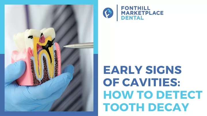 early signs of cavities how to detect tooth decay