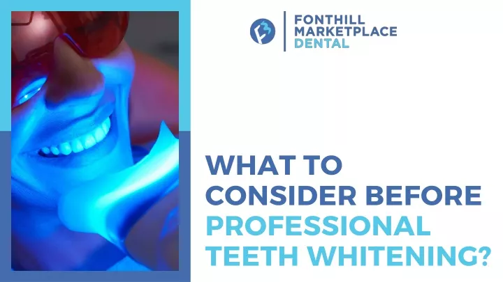 what to consider before professional teeth