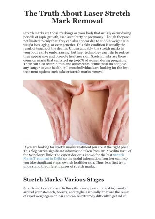 The Truth About Laser Stretch Mark Removal