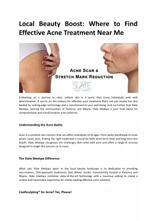 Where to Find Effective Acne Treatment Near Me.docx