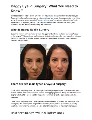 baggy eyelid surgery