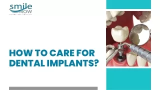 How to Care for Dental Implants