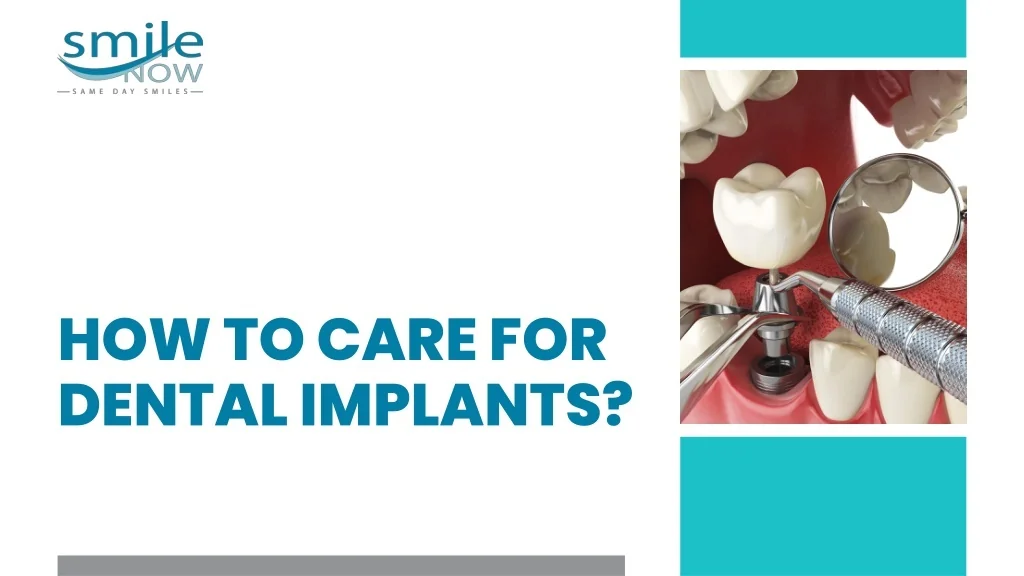 PPT - How to Care for Dental Implants PowerPoint Presentation, free ...