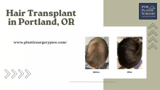 Revive Your Confidence with Hair Transplant in Portland, OR