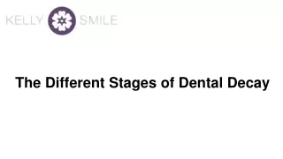 The Different Stages of Dental Decay |  Kelly Smile Dentistry Victorville