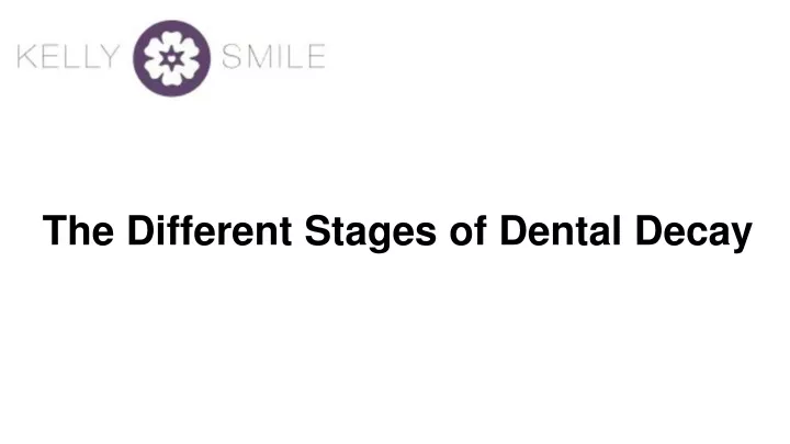 the different stages of dental decay