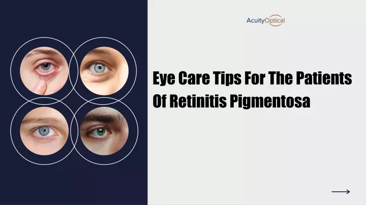 eye care tips for the patients of retinitis