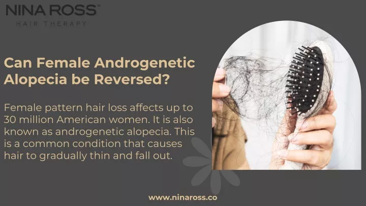 can female androgenetic alopecia be reversed