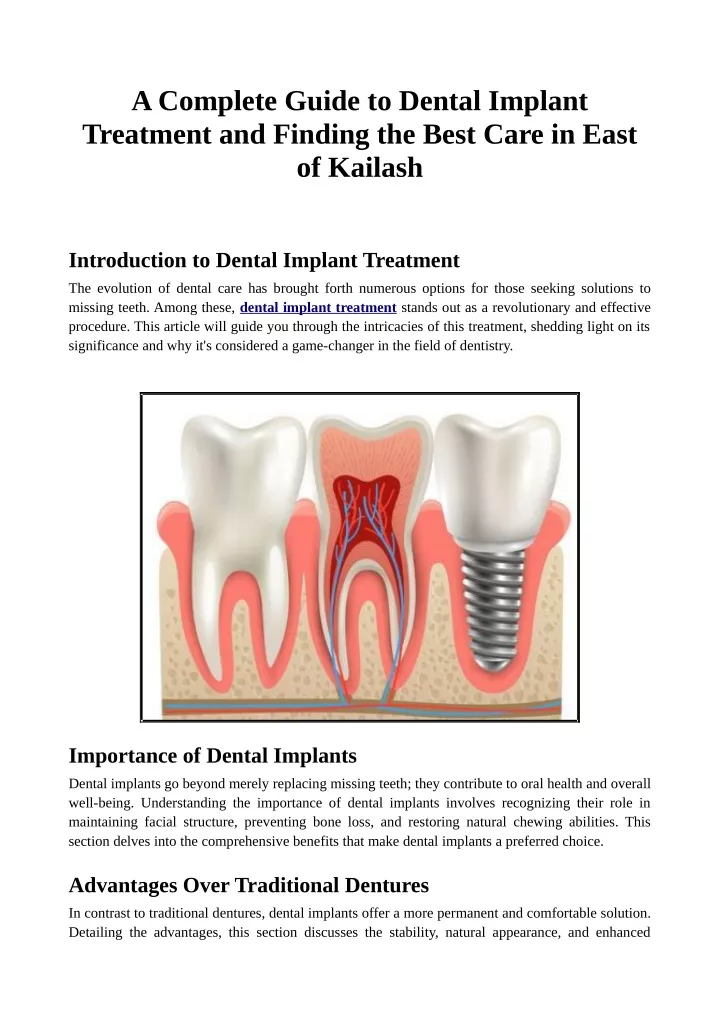 a complete guide to dental implant treatment