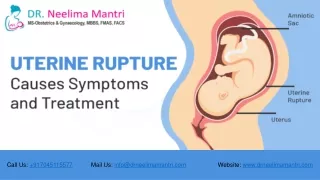 Uterine Rupture Causes Symptoms and Treatment | Dr Neelima Mantri