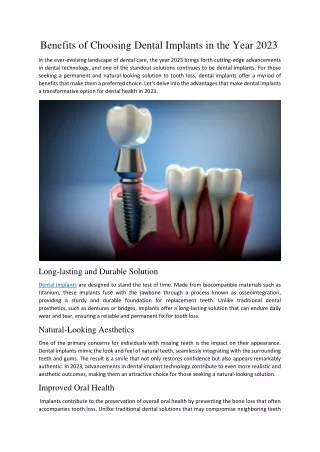 Benefits of Choosing Dental Implants in the Year 2023