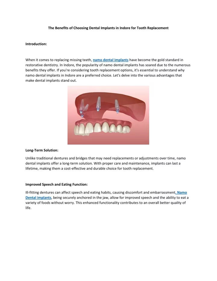 the benefits of choosing dental implants