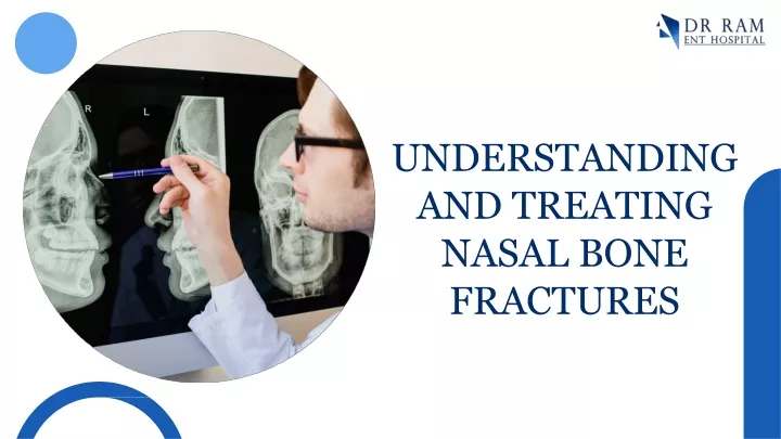 understanding and treating nasal bone fractures