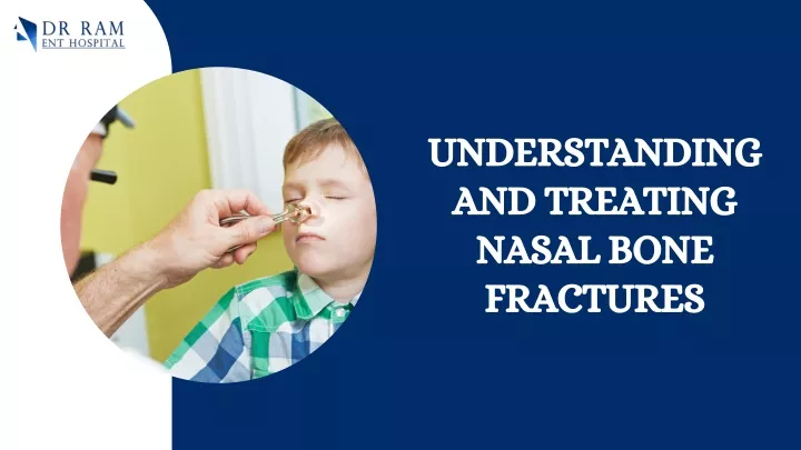 understanding and treating nasal bone fractures