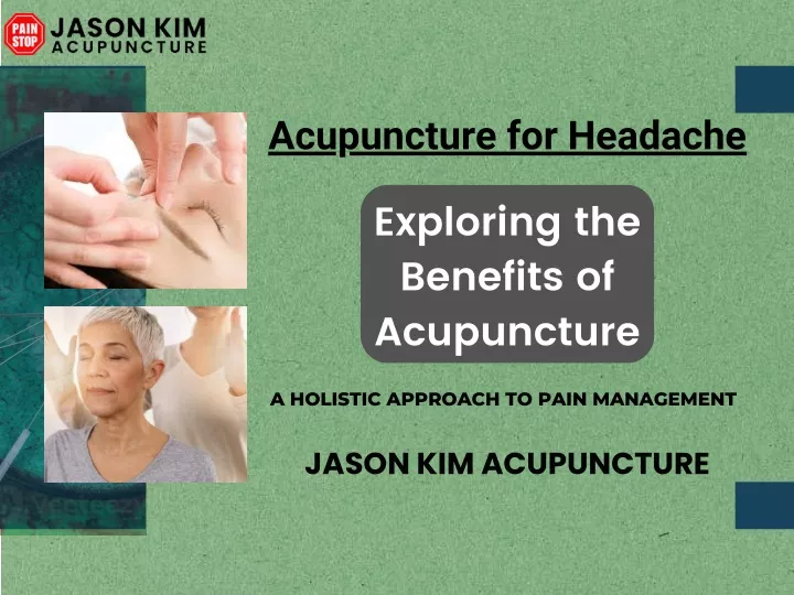 acupuncture for headache