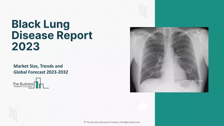 black lung disease report 2023