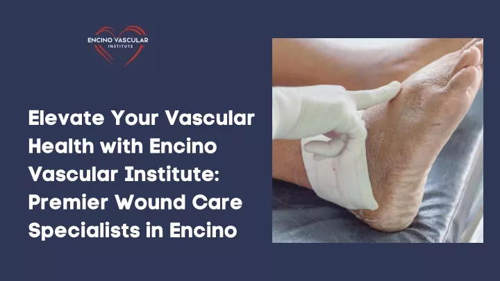 elevate your vascular health with encino vascular