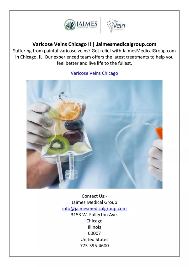 varicose veins chicago il jaimesmedicalgroup