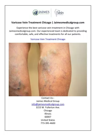 Varicose Vein Treatment Chicago  Jaimesmedicalgroup.com