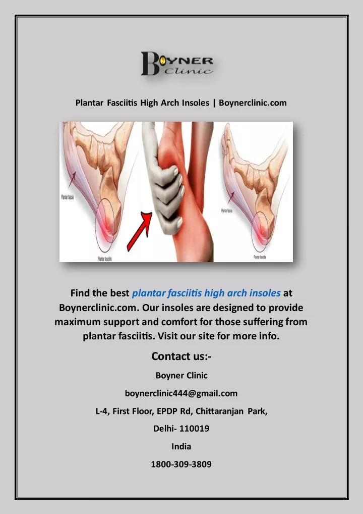 plantar fasciitis high arch insoles boynerclinic