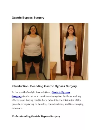 Gastric Bypass Surgery