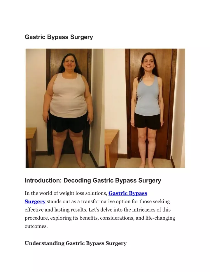gastric bypass surgery