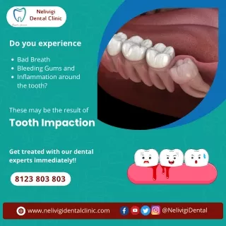 Signs of Tooth Impaction | NelivigiDental Clinic Bellandur, Bangalore