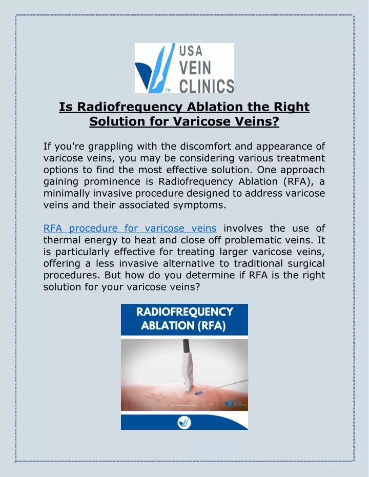 is radiofrequency ablation the right solution