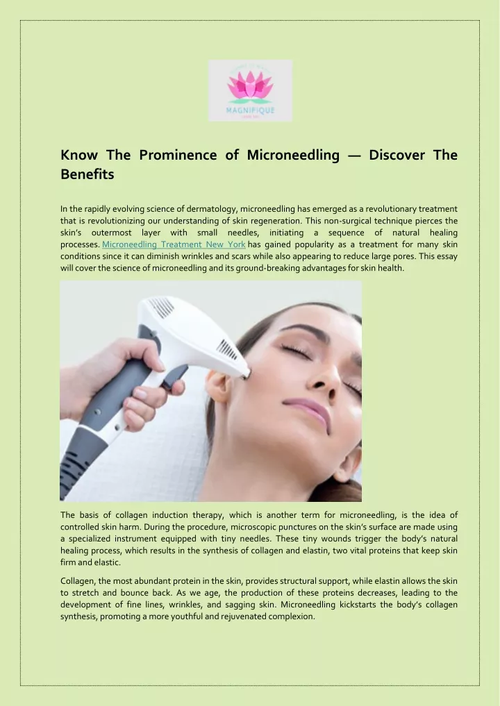 know the prominence of microneedling discover