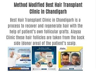 Method Modified Best Hair Transplant Clinic in Chandigarh