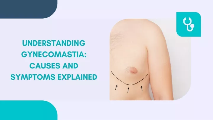 understanding gynecomastia causes and symptoms