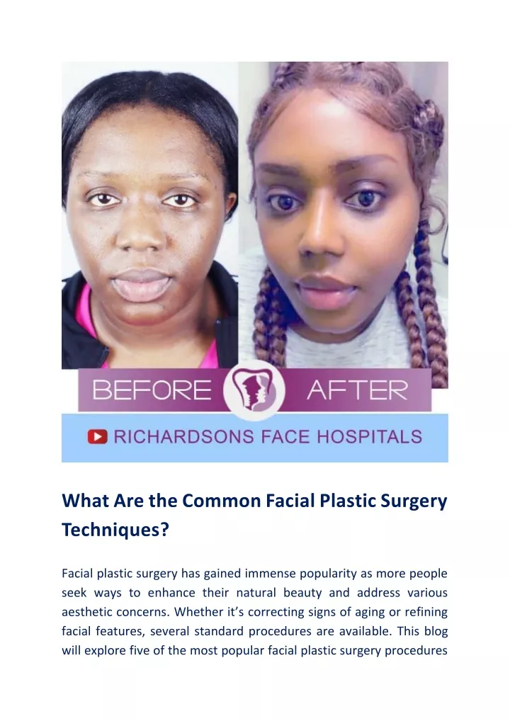 what are the common facial plastic surgery