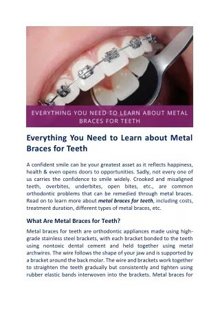 7 Questions You Need To Ask Before Getting Metal Braces For Teeth