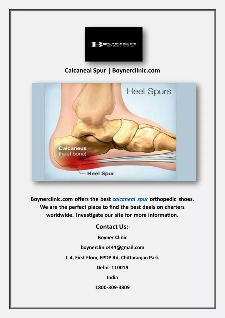 calcaneal spur boynerclinic com