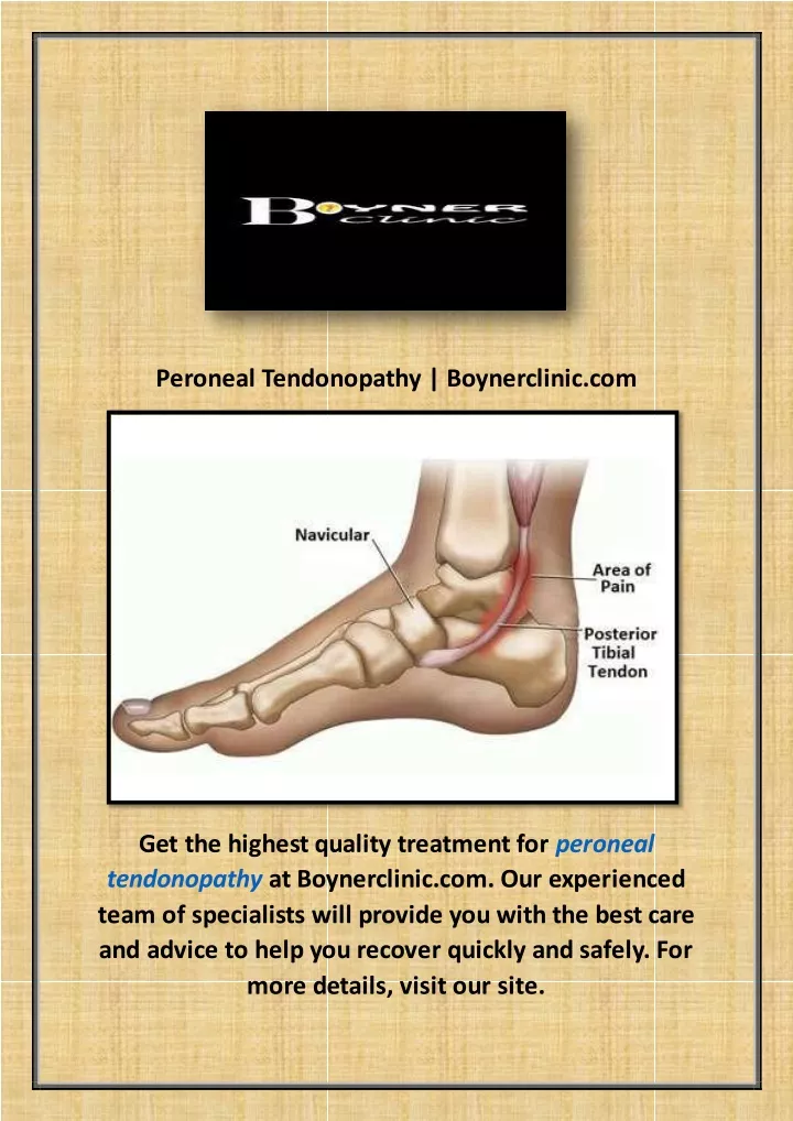 peroneal tendonopathy boynerclinic com