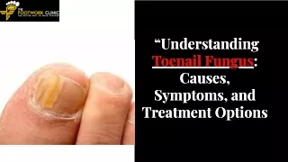 toenail-fungus-causes-symptoms-and-treatment