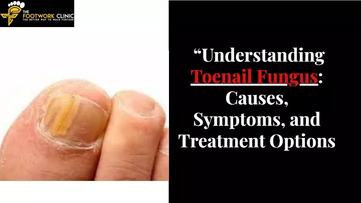 understanding toenail fungus causes symptoms