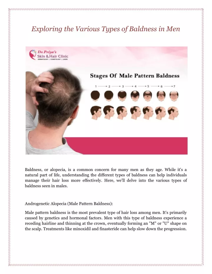 PPT - Exploring the Various Types of Baldness in Men PowerPoint ...