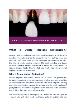 All That You Must Know About Dental Implant Restoration