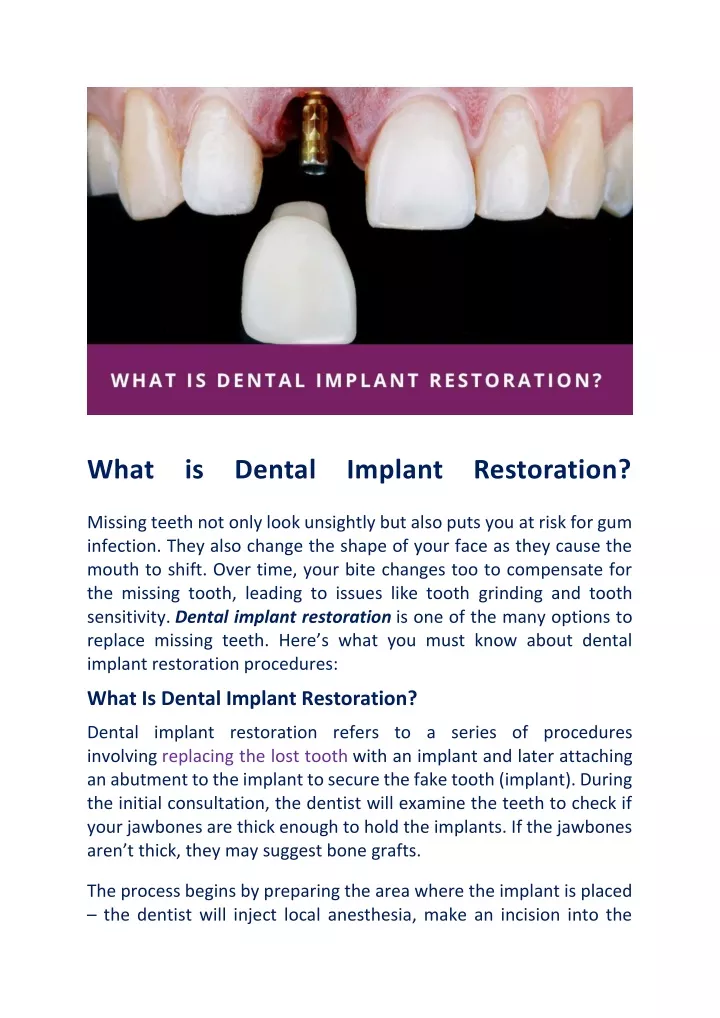 what is dental implant restoration missing teeth