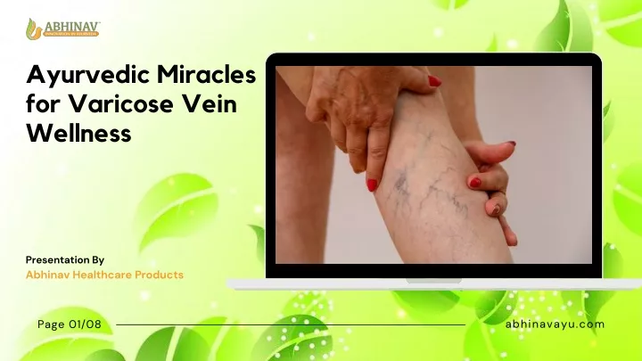 ayurvedic miracles for varicose vein wellness