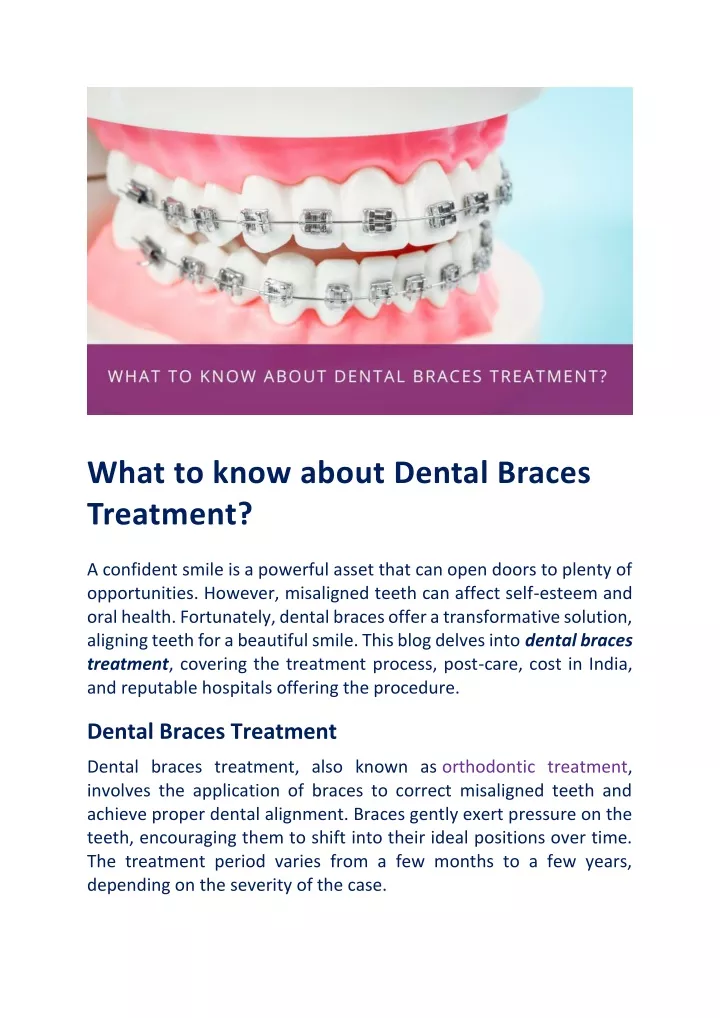 what to know about dental braces treatment
