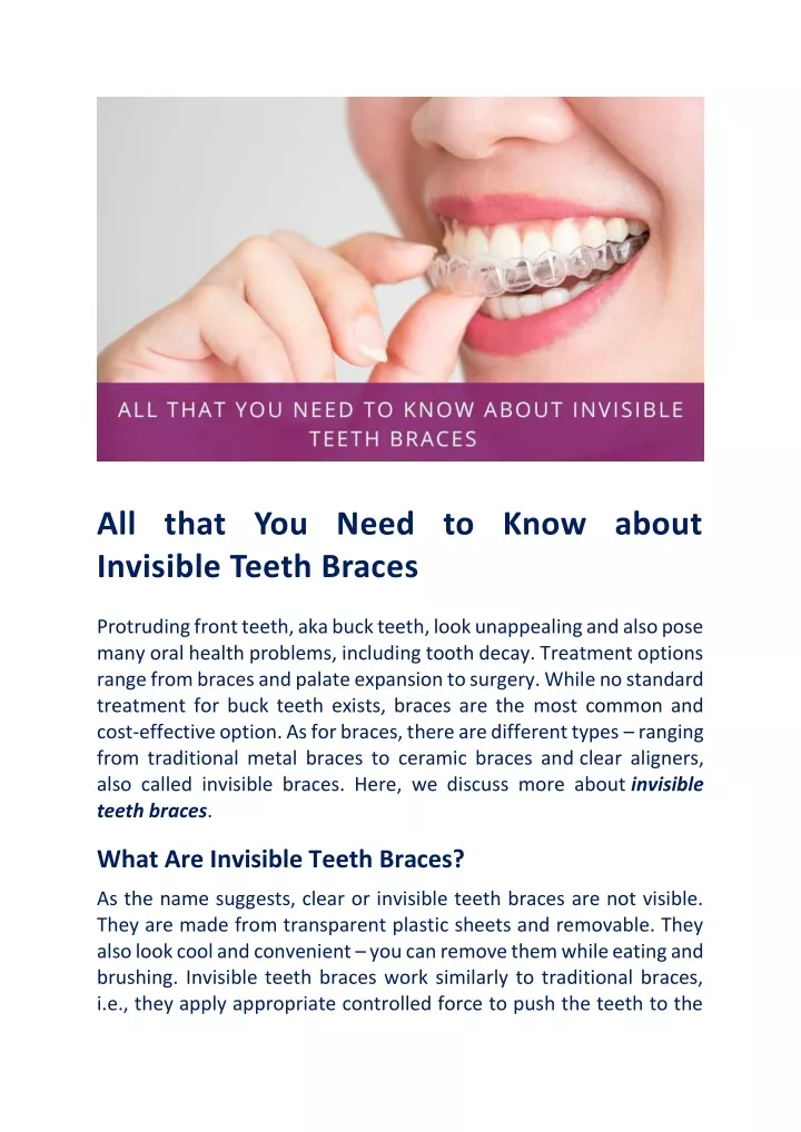 all that you need to know about invisible teeth
