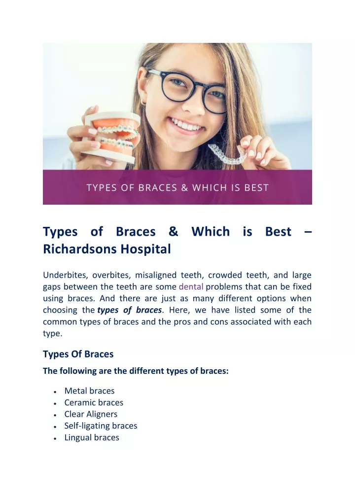 types of braces which is best richardsons