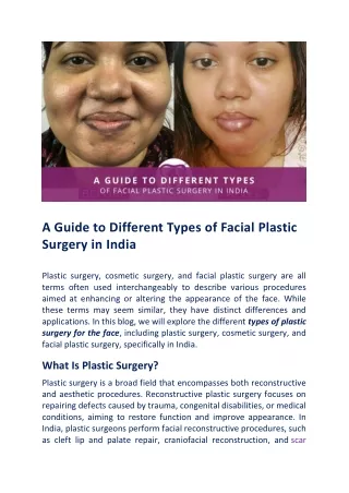 Different Types Of Plastic Surgery For Face