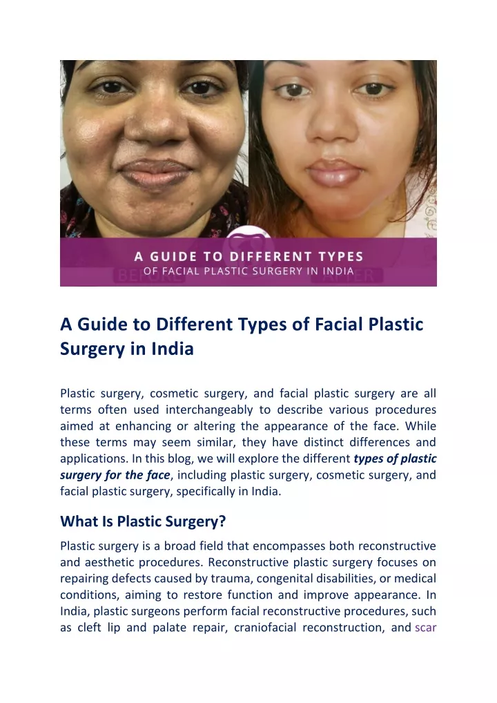 a guide to different types of facial plastic