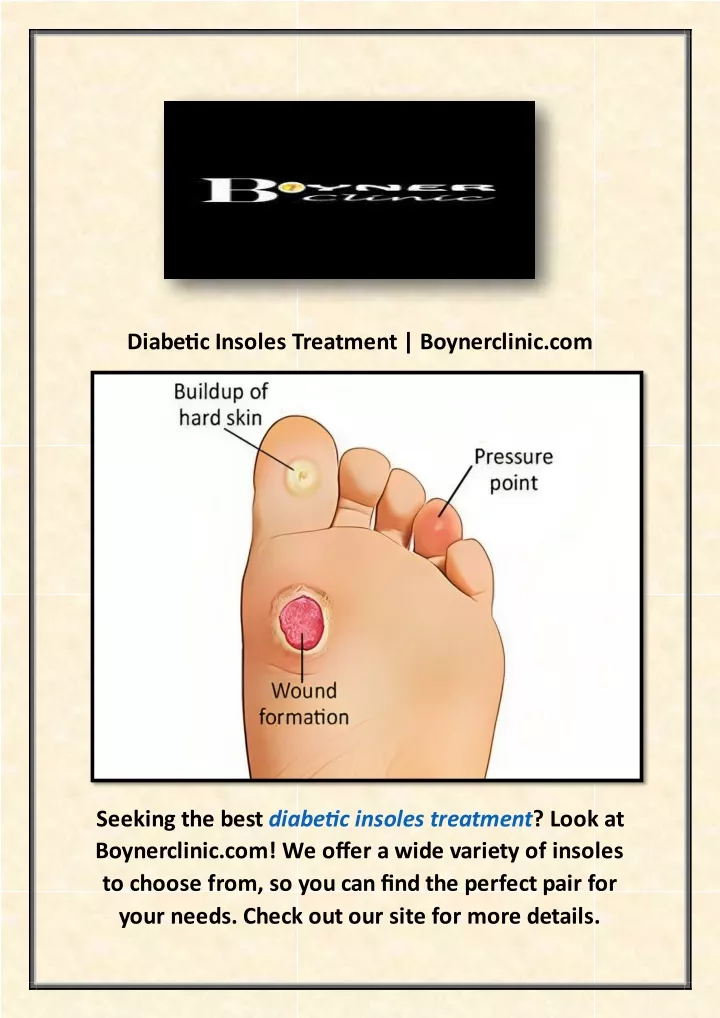 diabetic insoles treatment boynerclinic com