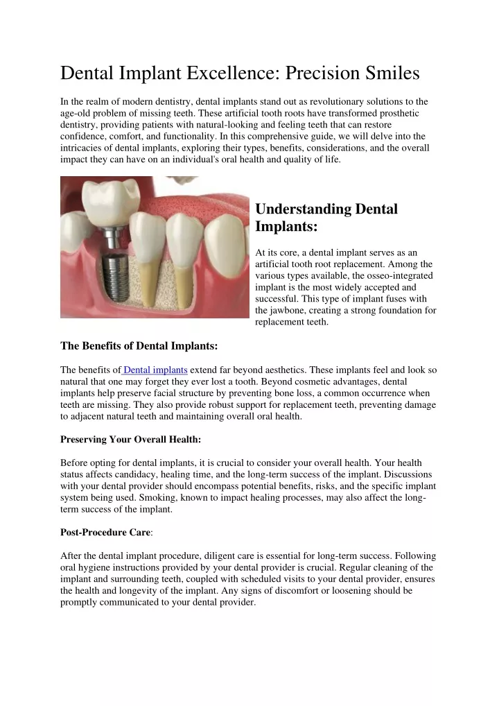 dental implant excellence precision smiles